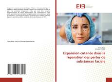 Bookcover of Expansion cutanée dans la réparation des pertes de substances faciale