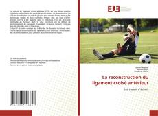 Borítókép a  La reconstruction du ligament croisé antérieur - hoz