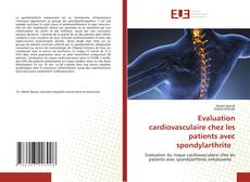 Bookcover of Evaluation cardiovasculaire chez les patients avec spondylarthrite