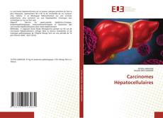 Bookcover of Carcinomes Hépatocellulaires