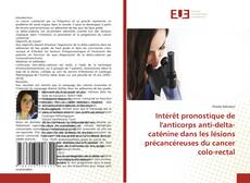 Capa do livro de Intérêt pronostique de l'anticorps anti-delta-caténine dans les lésions précancéreuses du cancer colo-rectal 