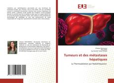 Capa do livro de Tumeurs et des métastases hépatiques 