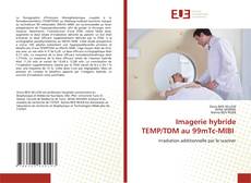 Bookcover of Imagerie hybride TEMP/TDM au 99mTc-MIBI
