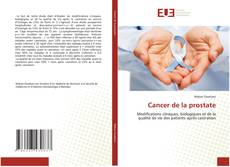 Cancer de la prostate的封面