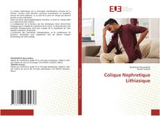 Bookcover of Colique Nephretique Lithiasique