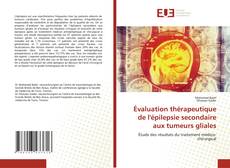 Évaluation thérapeutique de l'épilepsie secondaire aux tumeurs gliales kitap kapağı