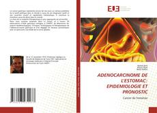 Capa do livro de ADENOCARCINOME DE L'ESTOMAC: EPIDEMIOLOGIE ET PRONOSTIC 