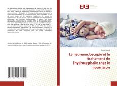Borítókép a  La neuroendoscopie et le traitement de l'hydrocephalie chez le nourrisson - hoz