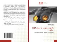 Bookcover of Ki67 dans le carcinome du sein