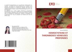 Bookcover of HOMOCYSTEINE ET THROMBOSES VEINEUSES PROFONDES