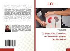 Bookcover of ATTEINTE RENALE AU COURS DES MICROANGIOPATHIES THROMBOTIQUES