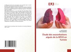 Étude des exacerbations aiguës de la BPCO en Tunisie的封面