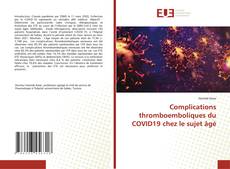 Bookcover of Complications thromboemboliques du COVID19 chez le sujet âgé