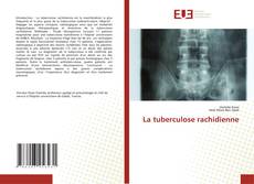 Bookcover of La tuberculose rachidienne