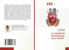 Bookcover of La maladie de Hirschsprung chez l’adulte