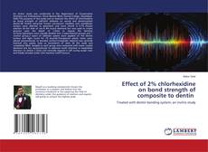 Copertina di Effect of 2% chlorhexidine on bond strength of composite to dentin