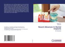 Copertina di Recent Advances In Dental Implants