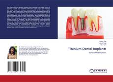 Copertina di Titanium Dental Implants