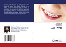 Copertina di ARCH WIRES