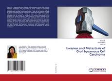 Copertina di Invasion and Metastasis of Oral Squamous Cell Carcinoma