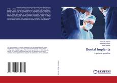 Copertina di Dental Implants