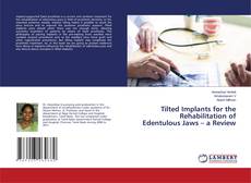 Copertina di Tilted Implants for the Rehabilitation of Edentulous Jaws – a Review