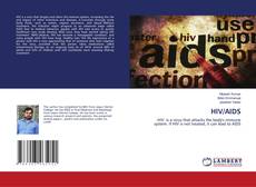 Copertina di HIV/AIDS