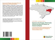 Bookcover of Doença de Chagas: Descrição Clínica de Novos Casos no Oeste da Bahia