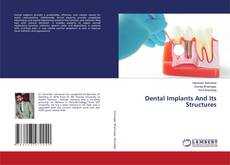 Copertina di Dental Implants And Its Structures