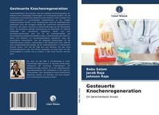 Couverture de Gesteuerte Knochenregeneration