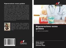 Rigenerazione ossea guidata的封面