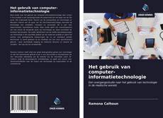 Bookcover of Het gebruik van computer-informatietechnologie