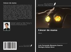 Bookcover of Cáncer de mama