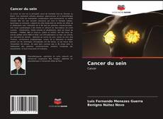 Buchcover von Cancer du sein