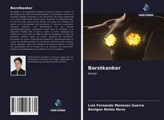 Bookcover of Borstkanker