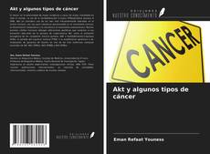 Copertina di Akt y algunos tipos de cáncer