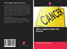 Bookcover of Akt e alguns tipos de câncer