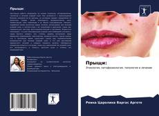 Portada del libro de Прыщи: