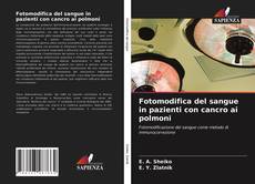 Bookcover of Fotomodifica del sangue in pazienti con cancro ai polmoni