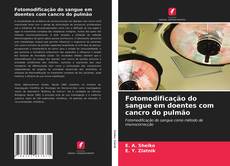 Couverture de Fotomodificação do sangue em doentes com cancro do pulmão