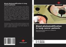 Borítókép a  Blood photomodification in lung cancer patients - hoz