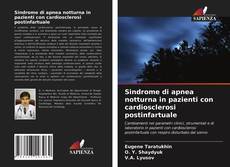 Sindrome di apnea notturna in pazienti con cardiosclerosi postinfartuale kitap kapağı