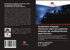 Couverture de Syndrome d'apnée nocturne chez les patients atteints de cardiosclérose post-farctus