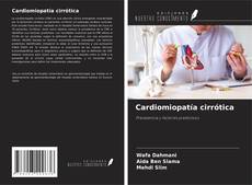 Buchcover von Cardiomiopatía cirrótica