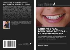 Bookcover of ADHESIVOS PARA DENTADURAS POSTIZAS - LA VERDAD REVELADA