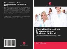 Bookcover of Hipervitaminose A em Organogénese e Morfometria Fetal.