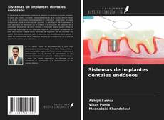 Portada del libro de Sistemas de implantes dentales endóseos