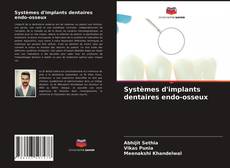 Couverture de Systèmes d'implants dentaires endo-osseux