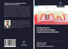 Bookcover of Endosseuze tandheelkundige implantaatsystemen