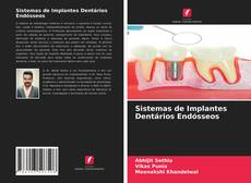 Buchcover von Sistemas de Implantes Dentários Endósseos